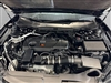 2025 Acura TLX w/A-Spec Package