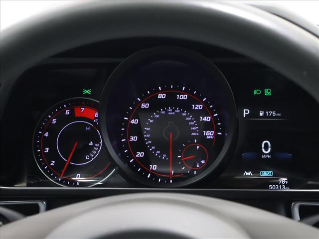 2023 Hyundai ELANTRA SEL:D13901