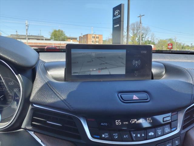 2021 Acura TLX Advance SH-AWD