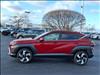 2024 Hyundai KONA Limited - thumbnail 8