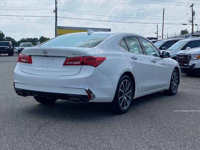 2018 Acura TLX V6