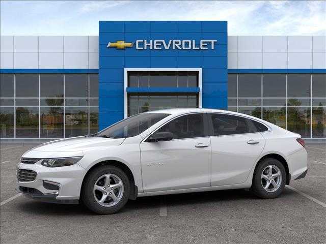 2018 Chevrolet Malibu SDN