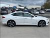 2025 Acura TLX Technology Package